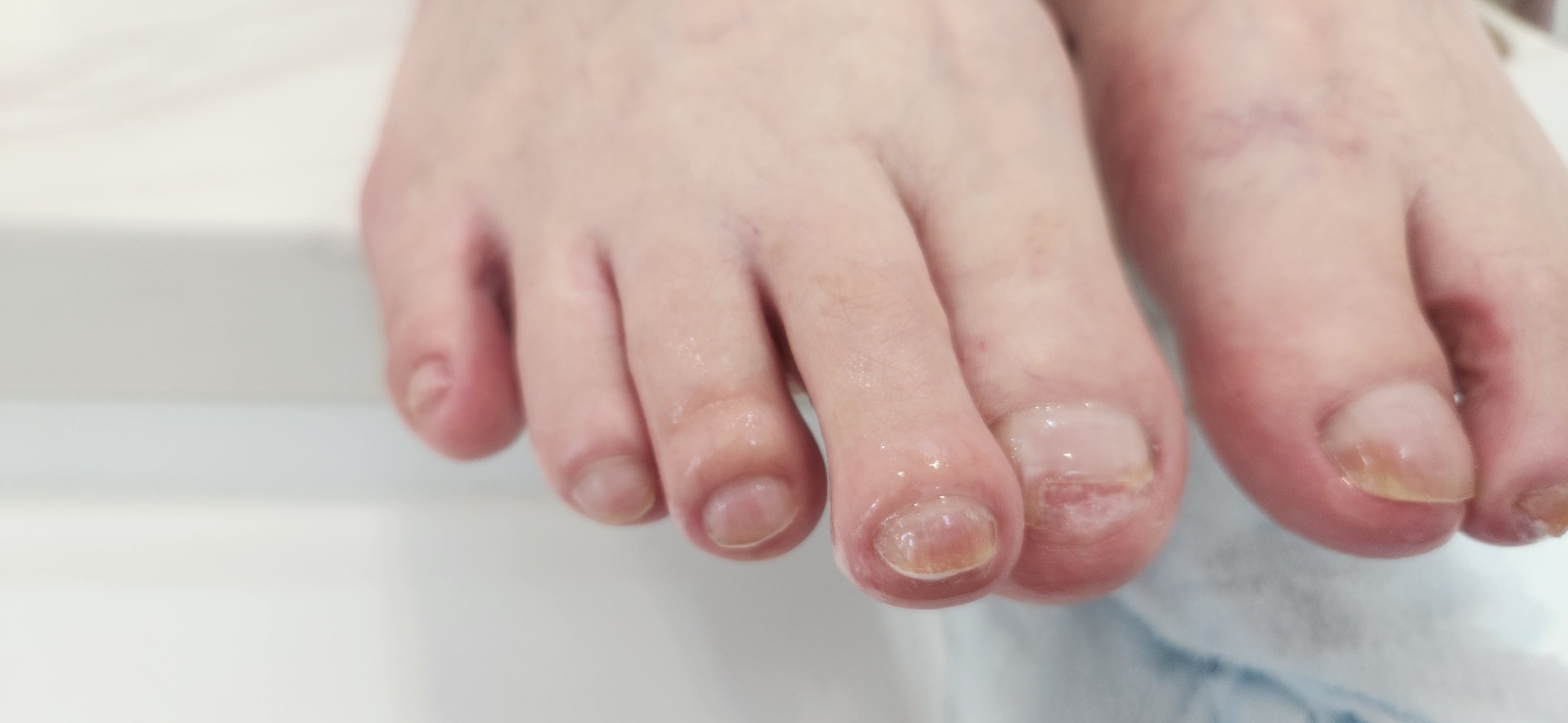 네일 케어 Before/After